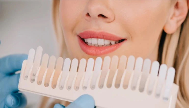 How Long Does A Dentist Cleaning Take?